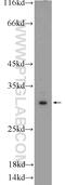 Pyridoxal Phosphate Binding Protein antibody, 25154-1-AP, Proteintech Group, Western Blot image 