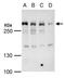 Mediator Complex Subunit 13 antibody, PA5-35924, Invitrogen Antibodies, Western Blot image 