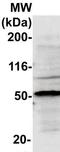 BLK Proto-Oncogene, Src Family Tyrosine Kinase antibody, TA354390, Origene, Western Blot image 