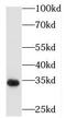 Peroxisomal trans-2-enoyl-CoA reductase antibody, FNab06300, FineTest, Western Blot image 