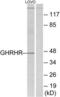 Growth Hormone Releasing Hormone Receptor antibody, LS-B6566, Lifespan Biosciences, Western Blot image 