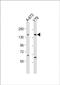 Calcium Voltage-Gated Channel Subunit Alpha1 F antibody, PA5-72277, Invitrogen Antibodies, Western Blot image 