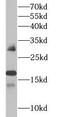 Interferon alpha-1/13 antibody, FNab04356, FineTest, Western Blot image 