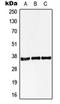 StAR Related Lipid Transfer Domain Containing 10 antibody, orb215018, Biorbyt, Western Blot image 