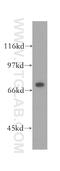 Signal Peptide Peptidase Like 2C antibody, 12664-1-AP, Proteintech Group, Western Blot image 