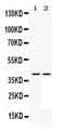 Dual specificity mitogen-activated protein kinase kinase 3 antibody, PA5-79626, Invitrogen Antibodies, Western Blot image 