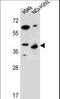 Protein Phosphatase 1 Regulatory Subunit 42 antibody, LS-C165891, Lifespan Biosciences, Western Blot image 