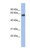 Keratin 75 antibody, NBP1-55237, Novus Biologicals, Western Blot image 