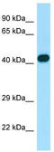Actin Related Protein 2/3 Complex Subunit 1B antibody, TA338142, Origene, Western Blot image 