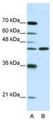 Neuromedin U Receptor 2 antibody, TA338591, Origene, Western Blot image 
