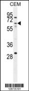 Zinc Finger Protein 674 antibody, 55-504, ProSci, Western Blot image 