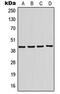 Potassium Voltage-Gated Channel Subfamily J Member 10 antibody, MBS821791, MyBioSource, Western Blot image 