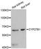 Cytochrome P450 Family 27 Subfamily B Member 1 antibody, abx125742, Abbexa, Western Blot image 