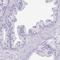 Dickkopf Like Acrosomal Protein 1 antibody, HPA047194, Atlas Antibodies, Immunohistochemistry paraffin image 