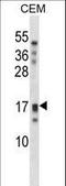 Kallikrein Related Peptidase 15 antibody, LS-C165583, Lifespan Biosciences, Western Blot image 