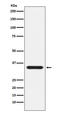 Presenilin 1 antibody, M00138-1, Boster Biological Technology, Western Blot image 