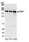 NRSF antibody, A300-540A, Bethyl Labs, Western Blot image 