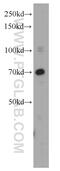 Menin 1 antibody, 15159-1-AP, Proteintech Group, Western Blot image 