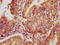 Listerin E3 Ubiquitin Protein Ligase 1 antibody, LS-C680795, Lifespan Biosciences, Immunohistochemistry paraffin image 