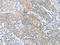 Slit homolog 2 protein antibody, CSB-PA245341, Cusabio, Immunohistochemistry paraffin image 