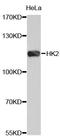 Hexokinase-2 antibody, abx126933, Abbexa, Western Blot image 