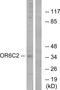 Olfactory Receptor Family 6 Subfamily C Member 2 antibody, GTX87766, GeneTex, Western Blot image 