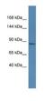 Melanoma-associated antigen E1 antibody, NBP1-91489, Novus Biologicals, Western Blot image 