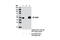CD209 Molecule antibody, 13193S, Cell Signaling Technology, Immunoprecipitation image 