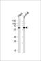 Heparanase 2 (Inactive) antibody, 56-786, ProSci, Western Blot image 