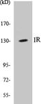 Insulin Receptor antibody, EKC1307, Boster Biological Technology, Western Blot image 