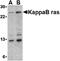 NFKB Inhibitor Interacting Ras Like 1 antibody, PA5-20340, Invitrogen Antibodies, Western Blot image 