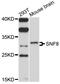 SNF8 Subunit Of ESCRT-II antibody, STJ112597, St John