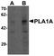Phospholipase A1 member A antibody, A09234-1, Boster Biological Technology, Western Blot image 