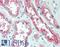Excitatory amino acid transporter 3 antibody, LS-B15395, Lifespan Biosciences, Immunohistochemistry paraffin image 