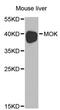 MOK Protein Kinase antibody, MBS127257, MyBioSource, Western Blot image 