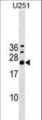 Exosome Component 4 antibody, LS-C159578, Lifespan Biosciences, Western Blot image 