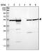 Zinc Finger And SCAN Domain Containing 22 antibody, PA5-52299, Invitrogen Antibodies, Western Blot image 