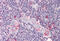 Tumor Protein P53 Regulated Apoptosis Inducing Protein 1 antibody, MBS240388, MyBioSource, Immunohistochemistry frozen image 