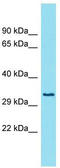 Calcium Homeostasis Modulator Family Member 5 antibody, TA335373, Origene, Western Blot image 