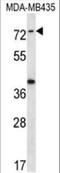 Synaptotagmin Like 1 antibody, MBS6010296, MyBioSource, Western Blot image 