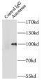 Autotaxin antibody, FNab00749, FineTest, Immunoprecipitation image 
