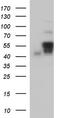 Annexin A7 antibody, TA590070, Origene, Western Blot image 