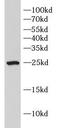 Type II HADH antibody, FNab10790, FineTest, Western Blot image 