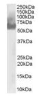 WASP antibody, orb18966, Biorbyt, Western Blot image 