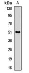 Pancreatic lipase antibody, orb412603, Biorbyt, Western Blot image 