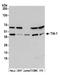 Nucleolysin TIA-1 antibody, A303-990A, Bethyl Labs, Western Blot image 