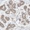 Cancer/testis antigen 1 antibody, NBP1-88736, Novus Biologicals, Immunohistochemistry paraffin image 