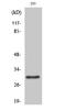 Ras-related protein Rab-34 antibody, A11097-2, Boster Biological Technology, Western Blot image 