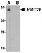 Leucine Rich Repeat Containing 26 antibody, A09062, Boster Biological Technology, Western Blot image 