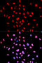 Bruton Tyrosine Kinase antibody, abx000168, Abbexa, Western Blot image 